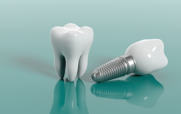 Model tooth compared to model dental implant supported replacement tooth