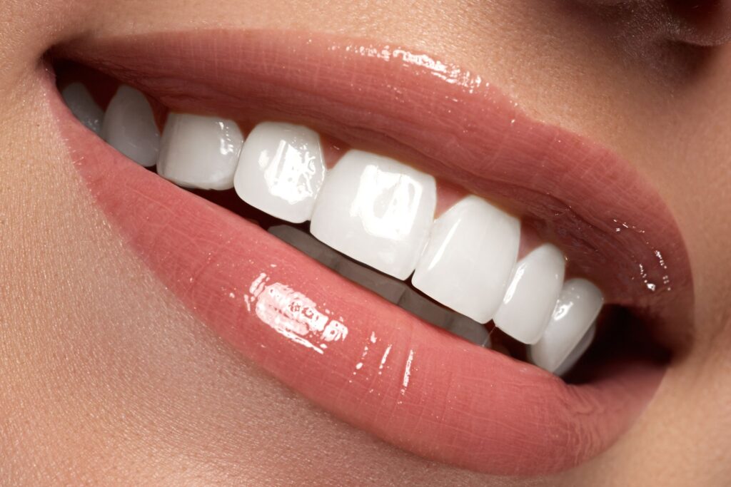 Closeup of a woman's perfect smile