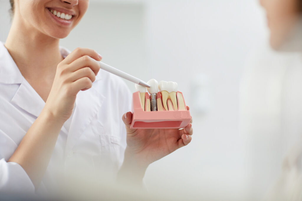 Smiling dentist showing patient model of dental implant